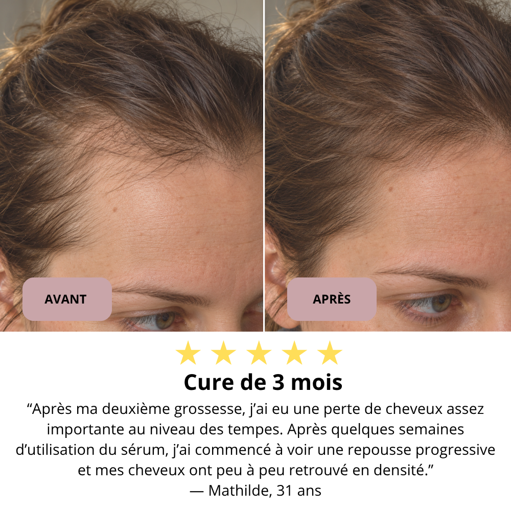 Sérum Boost Racines PDRN + Caféine