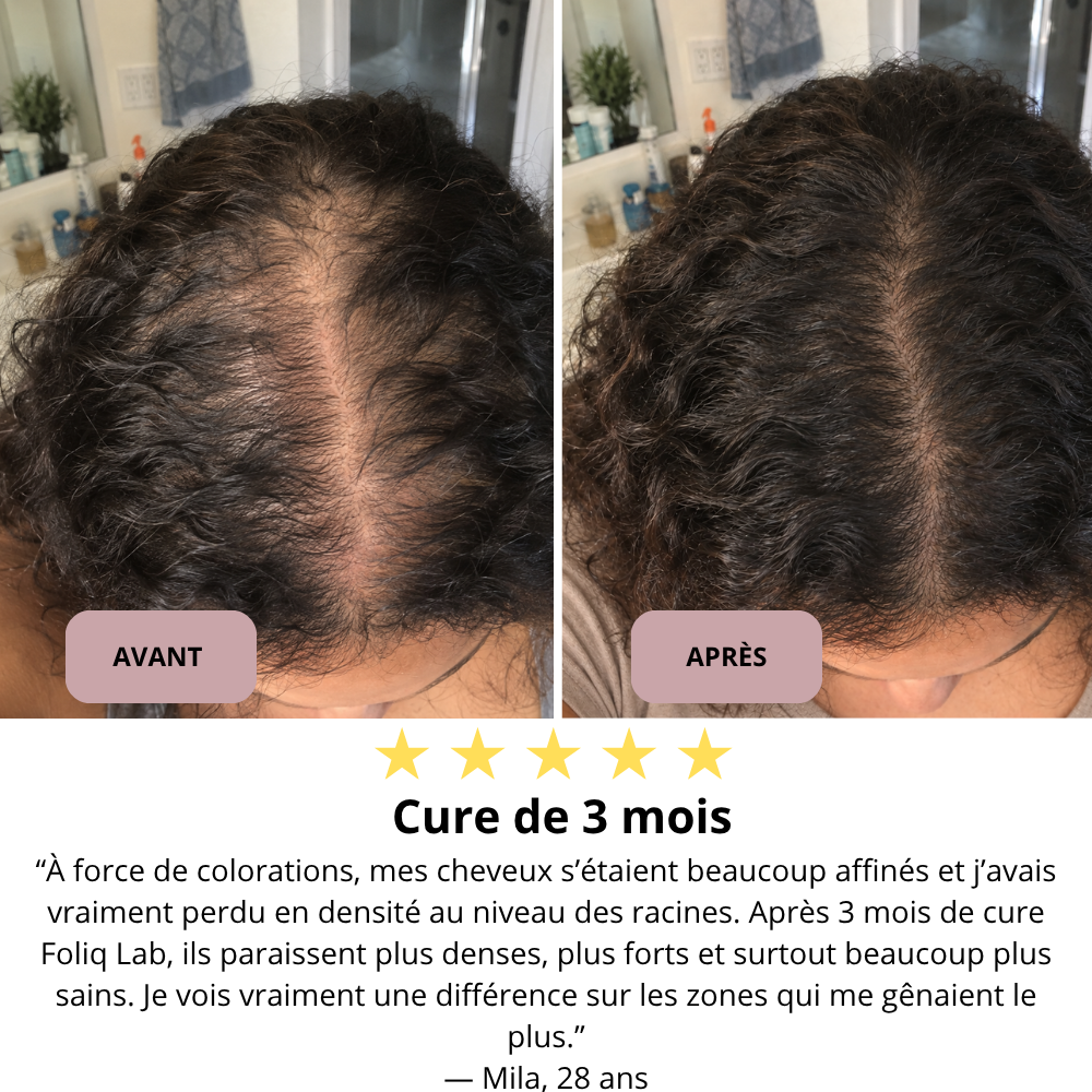 Sérum Boost Racines PDRN + Caféine